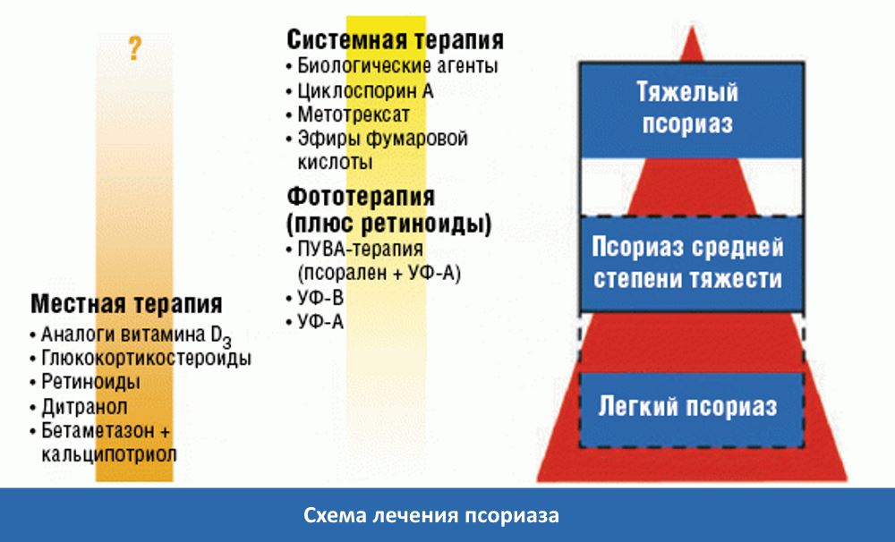 Венгерская схема лечения псориаза